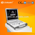 scanner de ultra-som Doppler colorido DW-C60 DAWEI marca &amp; 15 polegada tela LED ultrasound sonosite laptop